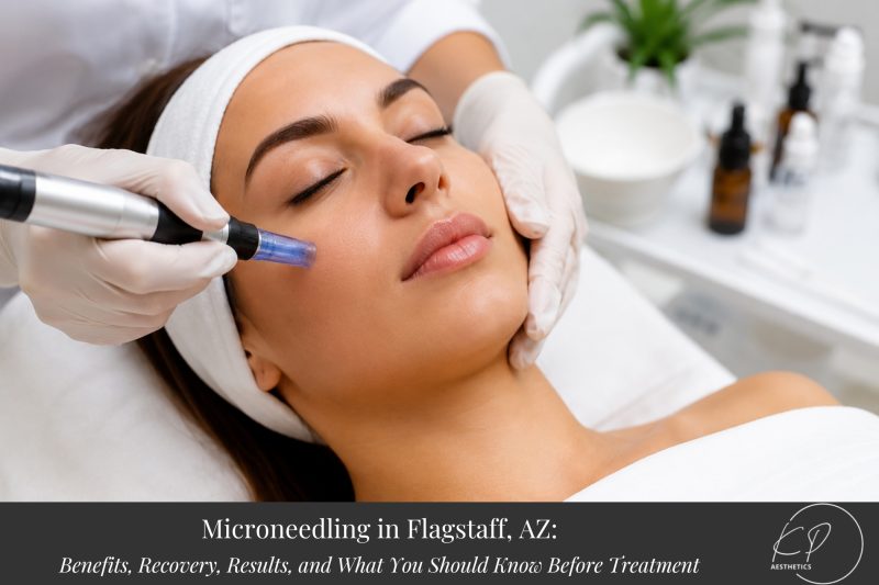 Microneedling in Flagstaff, AZ Benefits, Recovery, Results, and What You Should Know Before Treatment new